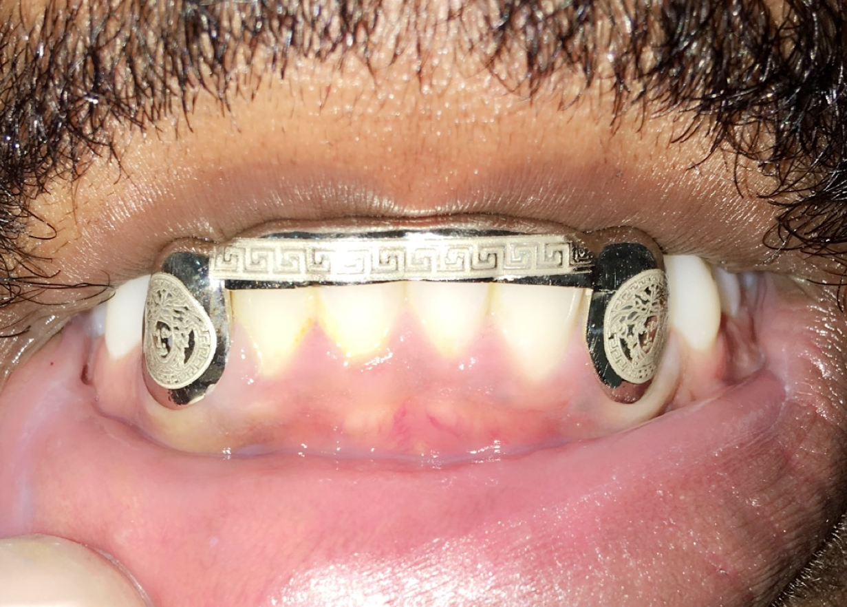 ClariOLED Transparent OLED Display price