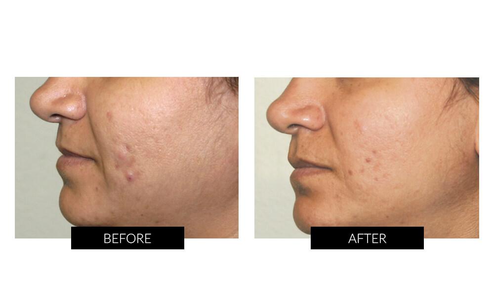 ClariOLED Transparent OLED Display price