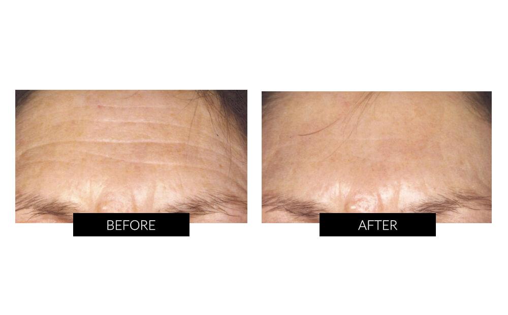 ClariOLED Transparent OLED Display price