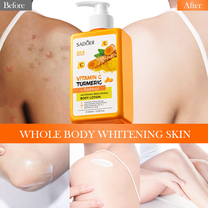 www.makeuphotsale.com
Vitamin C Turmeric Whitening Body Lotion
Makeuphotsale.com