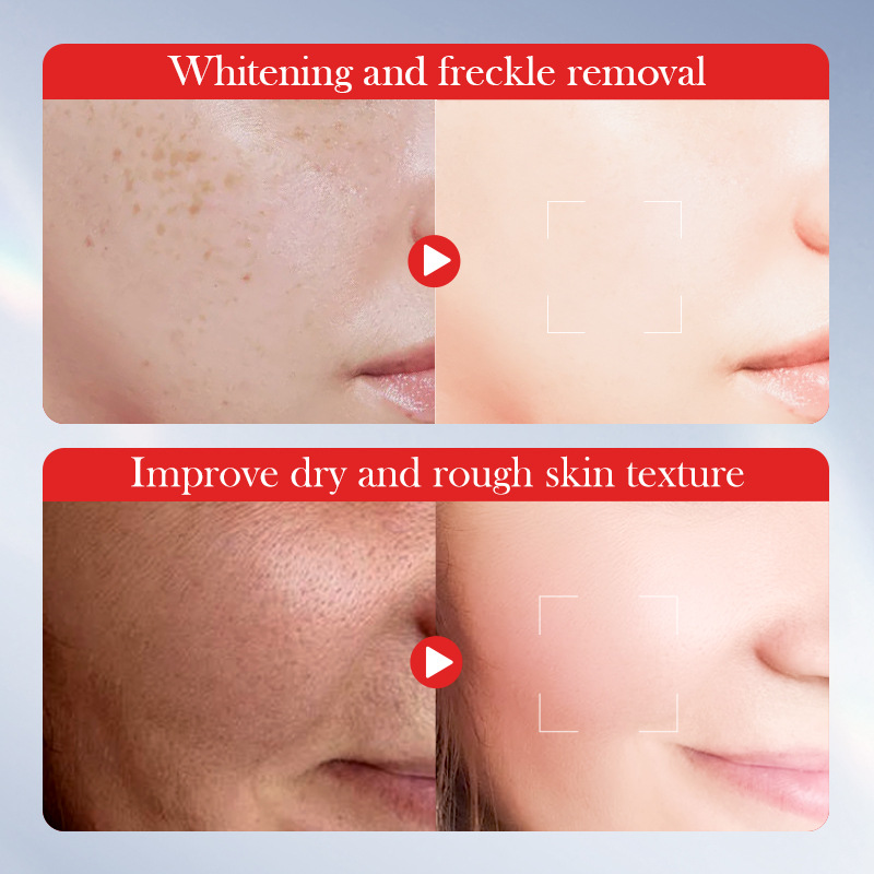 www.makeuphotsale.com
This freckle-removing cream has a molecular structure that effectively removes age spots.
Makeuphotsale.com