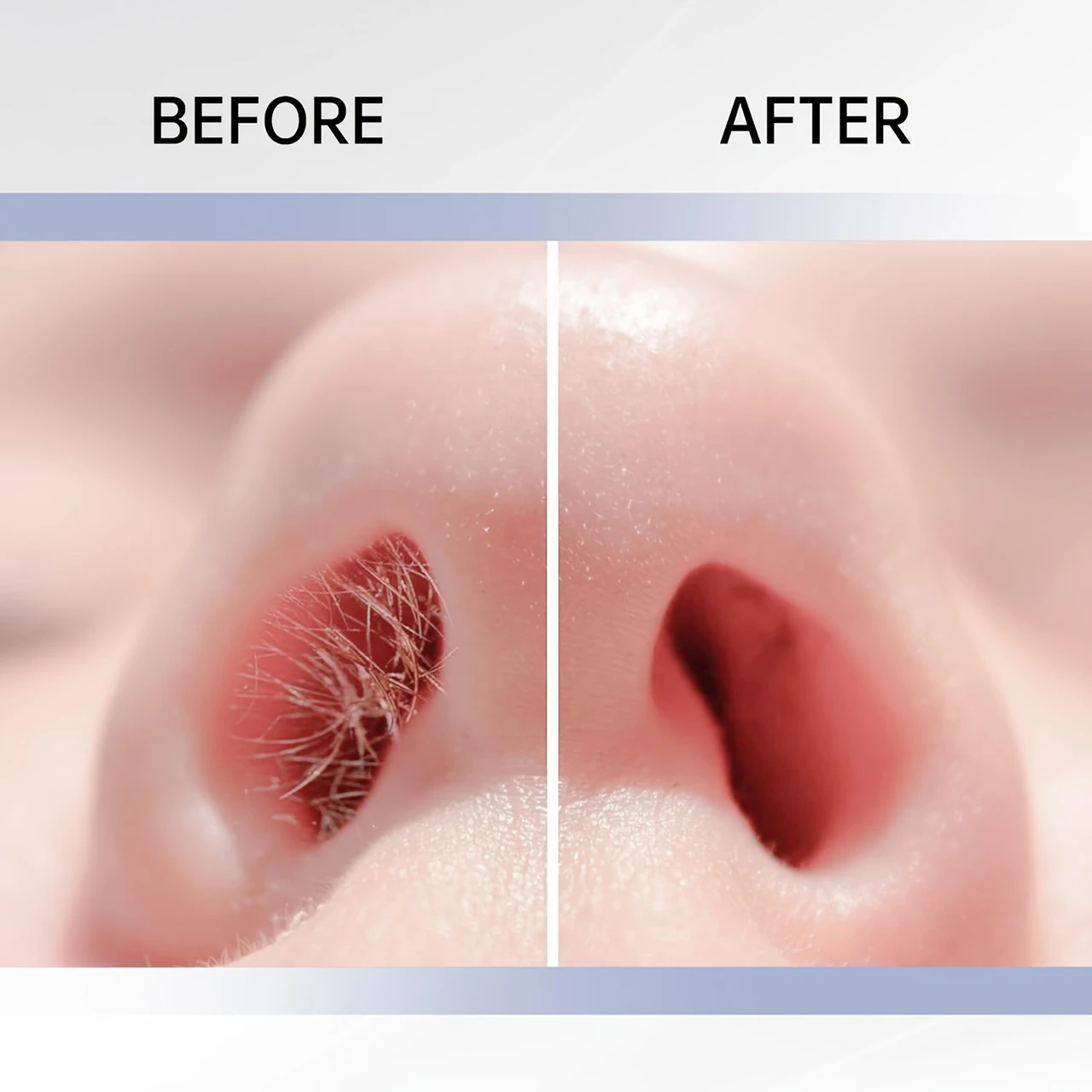 12pcs/8pc Dual-Sided Nose Hair Trimmer Kit, 2-In-1 Manual 360° Rotary Nose Hair Remover Tool with Ear Scoop, Suitable for Men And Women, Portable Grooming Device